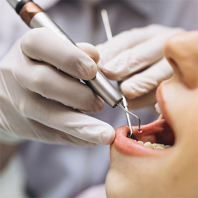 Clínica de Implantes Dentários