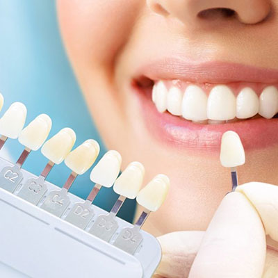 Estética Dental em Suzano