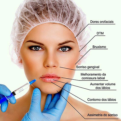 Harmonização Orofacial em Suzano