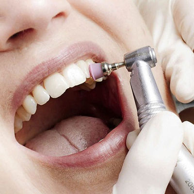 Limpeza Dentária em Suzano