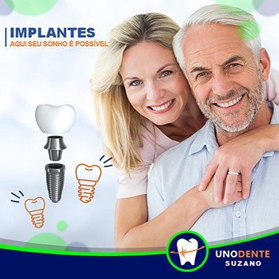 Implantes Dentários