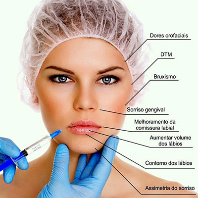 Harmonização Orofacial