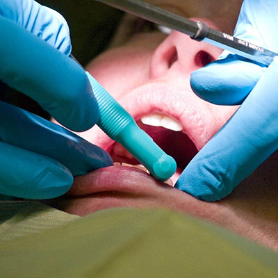 Tratamentos Dentários em Suzano